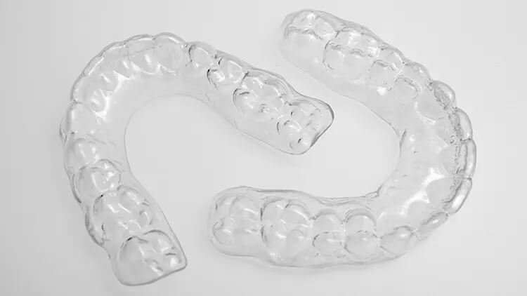 Custom Invisalign Image